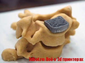 3d принтер может печатать искусственые кости