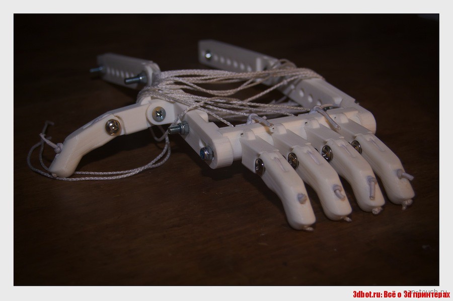 Протез руки сделали при помощи 3D-печати