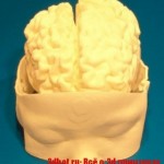 3D-печать при операциях на мозге