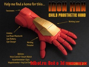 3D-печатный протез в виде руки IronMan
