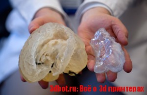 Ребенку напечатали его мозг на 3D принтере