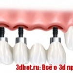 3d печать в стоматологии