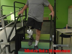 Бионический протез ноги