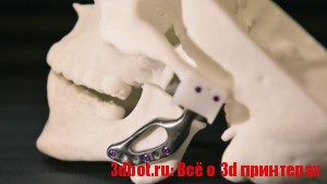 3D печатные челюсти