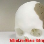 Возможности 3D печати в медицине