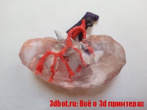 3D печать в хирургии внутренних органов человека