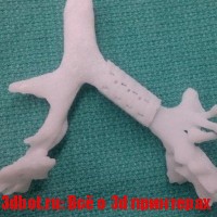 Полимерные медицинские имплантаты создают на 3d принтере