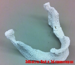 3D печатнь костно-полимерных имплантатов