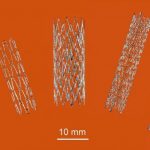 3D печатные стенты из никелида титана