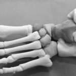 Регенерация костей с помощью 3d-печати