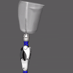 3D-печатный имплантат конечностей