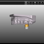 3D-моделирование зубочелюстного аппарата