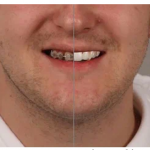 3d-моделирование в стоматологии