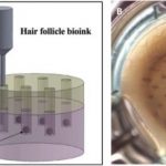 3D-печатная человеческая кожа с волосами