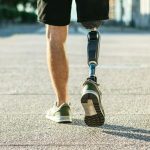 Управляемый бионический коленный протез
